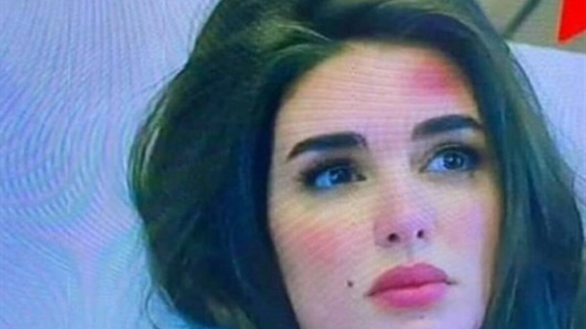 وقعت الممثلة المصرية ياسمين صبري بطلة مسلسل "فرصة ثانية" في خطأ اعتبره البعض "فادح؛ حين ظهرت في الحلقة الأولى من مسلسلها بمكياج كامل بعد إصابتها في حادث سير.