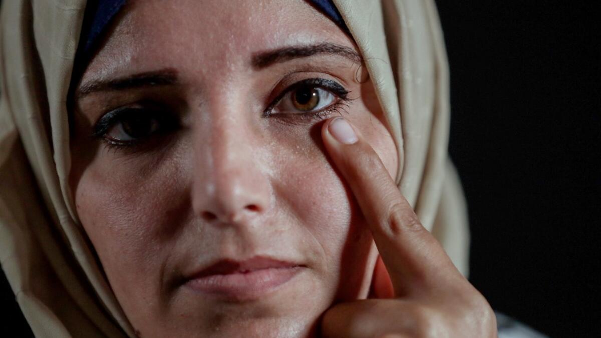 Jacqueline Shahada, who lost her left eye in the ongoing conflict with Israel, poses during a photo session in Bureij refugee camp in central Gaza on February 4, 2020. Along the border of the Gaza Strip, the Israeli army uses snipers who, according to instructions, open fire only when the soldiers are at risk from intensifying violence from Palestinian rioters. Some were taking part in clashes, others simply in the wrong place at the wrong time. All were left scarred and their lives wrecked, even though in