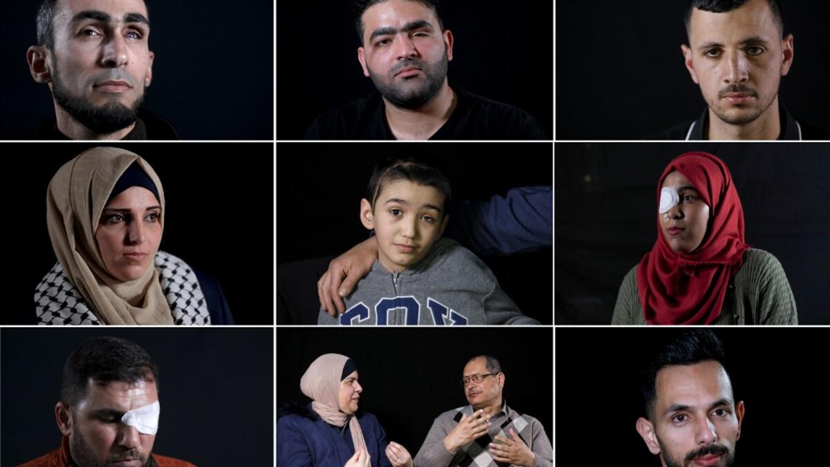 This combination of pictures created on June 8, 2020, shows (top L to R) Ahmed al-Louth, who lost his left eye, posing during a photo session in Bureij refugee camp in central Gaza; Muath Amarneh, who lost his left eye, posing during a photo session in Ramallah; Mohammed Burqan, who lost his right eye, posing during a photo session in Jerusalem; (middle L to R) Jacqueline Shahada, who lost her left eye, posing during a photo session in Bureij refugee camp in central Gaza; Malek Issa, 9, lost his left eye