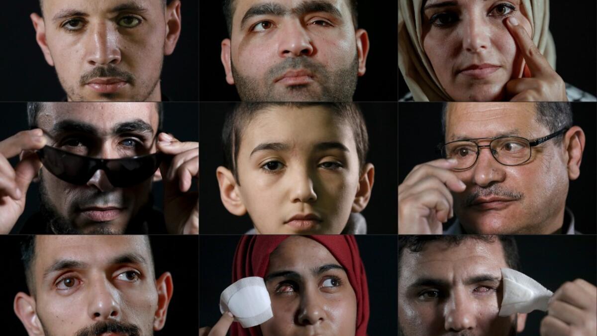 This combination of pictures created on June 11, 2020 shows (Top L to R) Mohammed Burqan, who lost his left eye, posing during a photo session in Jerusalem; Muath Amarneh, who lost his left eye, posing during a photo session in Ramallah; Jacqueline Shahada, who lost her left eye, posing during a photo session in Bureij refugee camp in central Gaza; (Middle L to R) Ahmed al-Louth, who lost his left eye, posing during a photo session in Bureij refugee camp in central Gaza; Malek Issa, 9, who lost his left eye