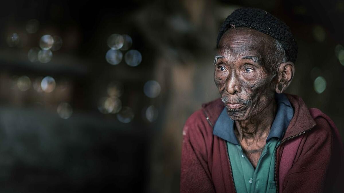 A frail-looking tribesman wears green shirt and red jacket with a black wool hat in what appears to be a merging of traditional culture with more western fashion trends. (Mediadrumimages/ Trevor Cole)