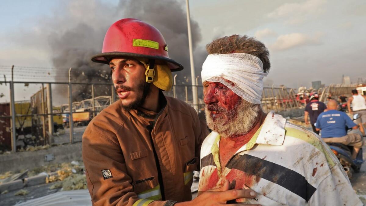 A wounded man is helped by a fireman near the scene of an explosion in Beirut on August 4, 2020. Two huge explosion rocked the Lebanese capital Beirut, wounding dozens of people, shaking buildings and sending huge plumes of smoke billowing into the sky. Lebanese media carried images of people trapped under rubble, some bloodied, after the massive explosions, the cause of which was not immediately known.  ANWAR AMRO / AFP