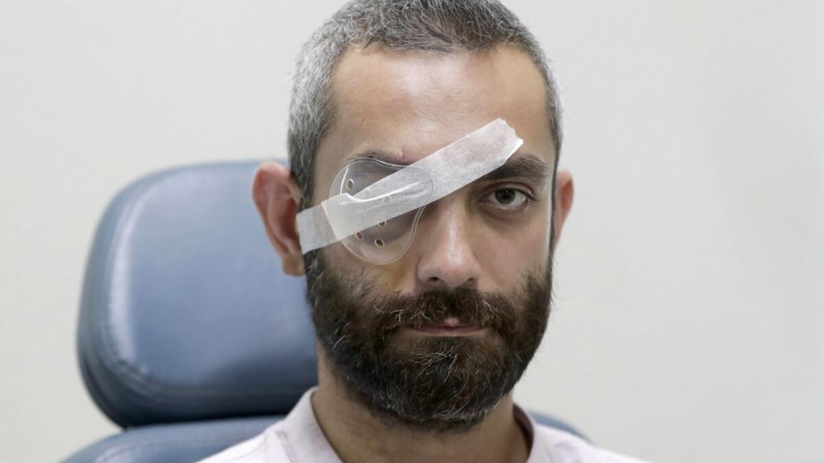 Maroun Dagher, 34-year-old web developer who lost sight in one eye due to the August 4 cataclysmic explosion, poses for a picture during his third checkup at the Eye and Ear hospital, north of the Lebanese capital Beirut, on August 17, 2020. ANWAR AMRO / AFP