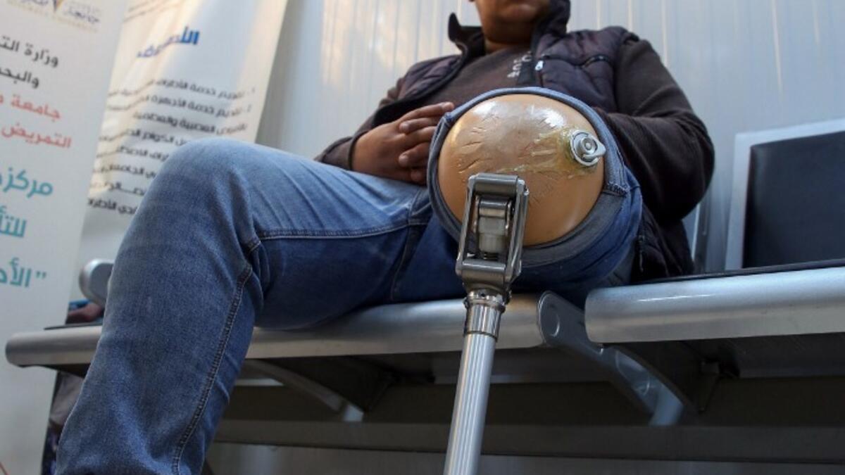 A patient waits for a consultation at the National Center for Artificial Limbs, in Libya's port city of Misrata, on December 17, 2020. With Libya's health sector left in tatters by its multiple conflicts since the 2011 revolution, war-wounded Libyans are often sent abroad for treatment, at the expense of the state. However, A national centre for prostheses, being established in Misrata, already has a patient waiting list of more than 3,000 amputees