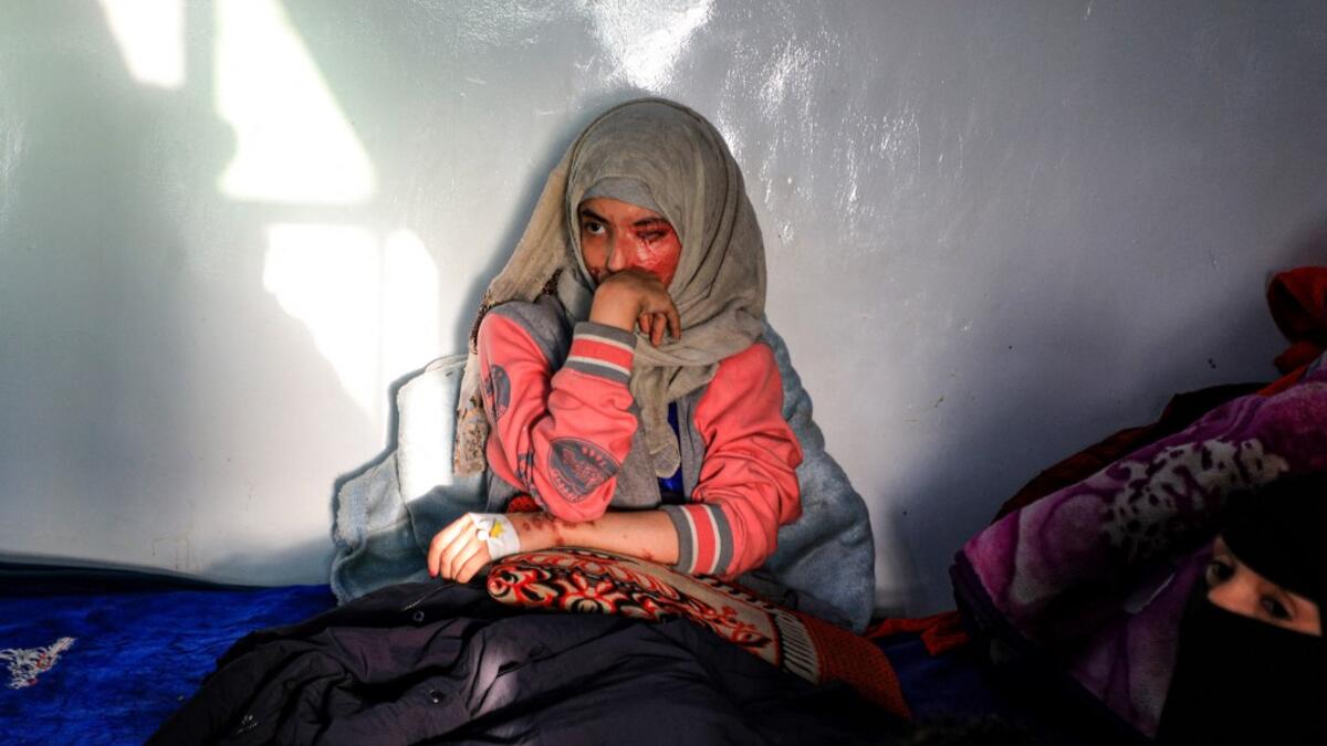 Al-Anoud Hussain Sheryan, a 19-year-old girl disfigured in an acid attack by her abusive husband, sits at a hospital where she is undergoing treatment in Yemen's capital Sanaa on January 28, 2021. Married at the age of 12, rejected at 16, and then disfigured in an acid attack, Sheryan's fate is a shocking illustration of abuse in a society beset by war and poverty. Now aged 19, the young Yemeni woman agreed to relate her ordeal at the hands of her abusive husband -- rare testimony in a country where domesti