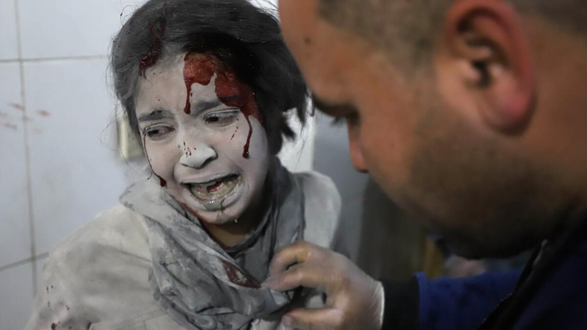 Syrian girl receives treatment as victims of reported regime air strikes