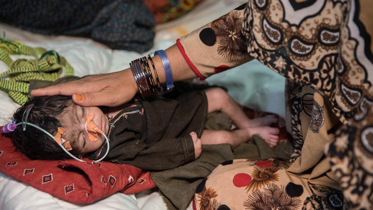 منذ ديسمبر 2019 ، تدعم المنظمة مركز التغذية العلاجية للمرضى الداخليين التابع لمستشفى هرات الإقليمي والذي يضم 40 سريرًا للأطفال الذين يعانون من سوء التغذية الحاد، لكن غالبية المرضى والقائمين على رعايتهم يسافرون لأكثر من 15 كيلومترًا للحصول على الرعاية.