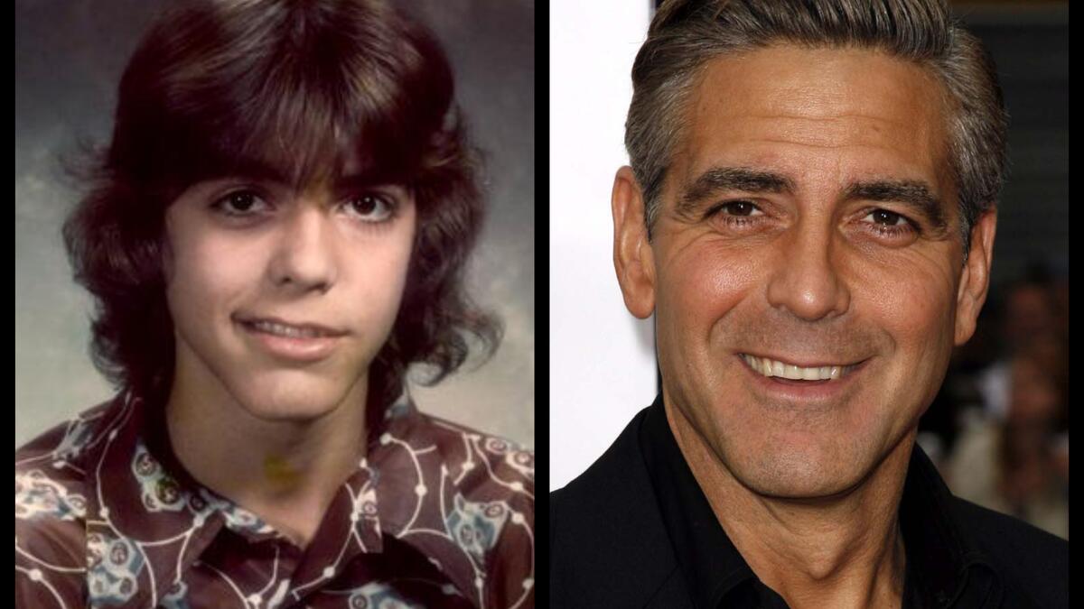 جورج كلوني: أصيب عندما كان في الرابعة عشر من عمره بشلل بيل وتسبب في شل نصف وجهه لمدة 6 أشهر واجه خلالها الكثير من المصاعب ومنها عدم القدرة على الأكل أو الشرب.