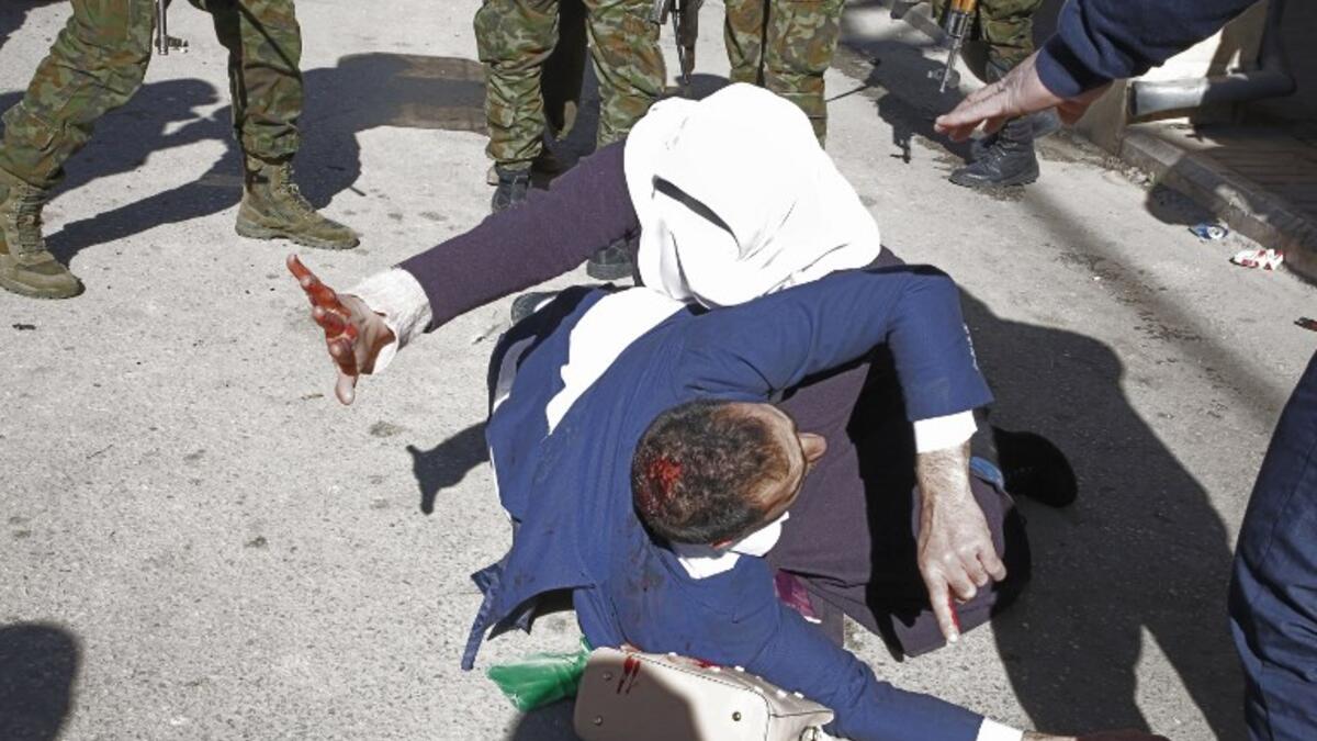 A Palestinian woman shields her injured husband as Palestinian security forces try to disperse a rally of Hamas supporters, marking the 31st anniversary of the founding of the Islamist movement.
HAZEM BADER / AFP