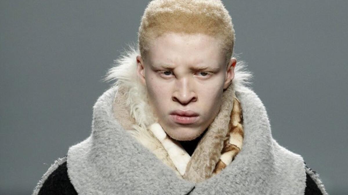 يعتبر "شون روس" أول عارض أزياء من فئة الالبينو، بدأ مسيرته في عرض الأزياء بعمر الـ16، وهو الآن يتصدر أغلفة أهم المجلات العالمية كـ GQو Vogue