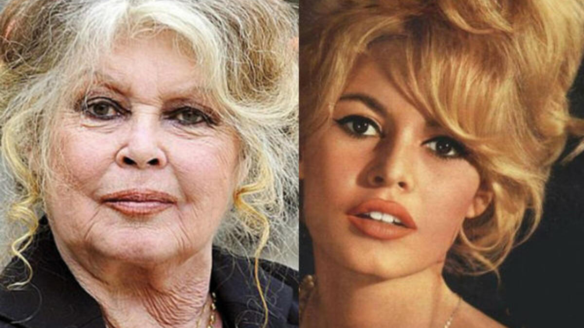 تلقت النجمة الفرنسية الشهيرة بريجيت باردو تلقت علاجها من المرض نفسه، وبعد فترة من العلاج بدأت أعراض المرض تنحسر من جسدها، حتى تغلبت عليه تمامًا وشفيت منه بشكلٍ كامل.