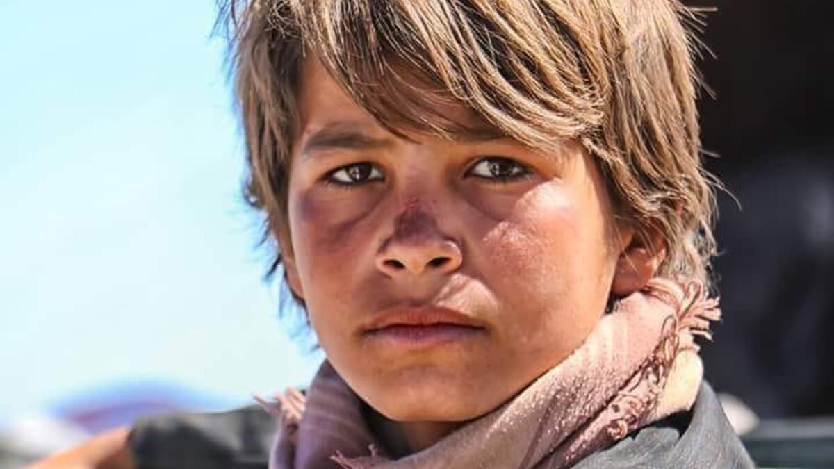 The world must act now to save Yemeni children (Twitter)