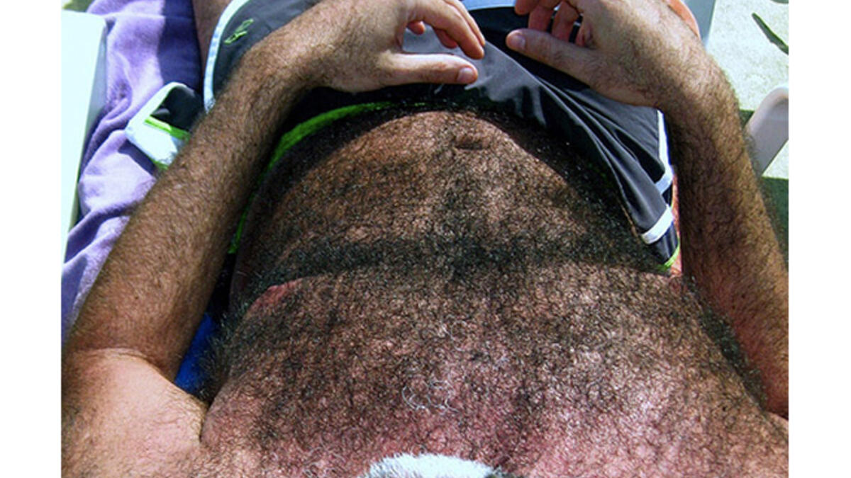 hairy man body