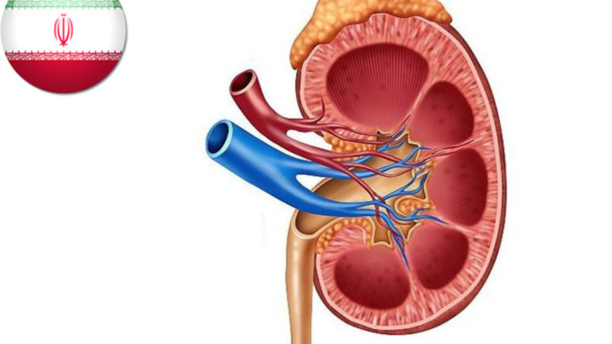 This one we can’t really wrap our head around, but the most Googled cost estimation in Iran was a kidney. The question at hand is really, are they looking to buy or sell?!