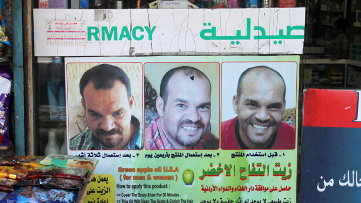 hair tonic baldness cure