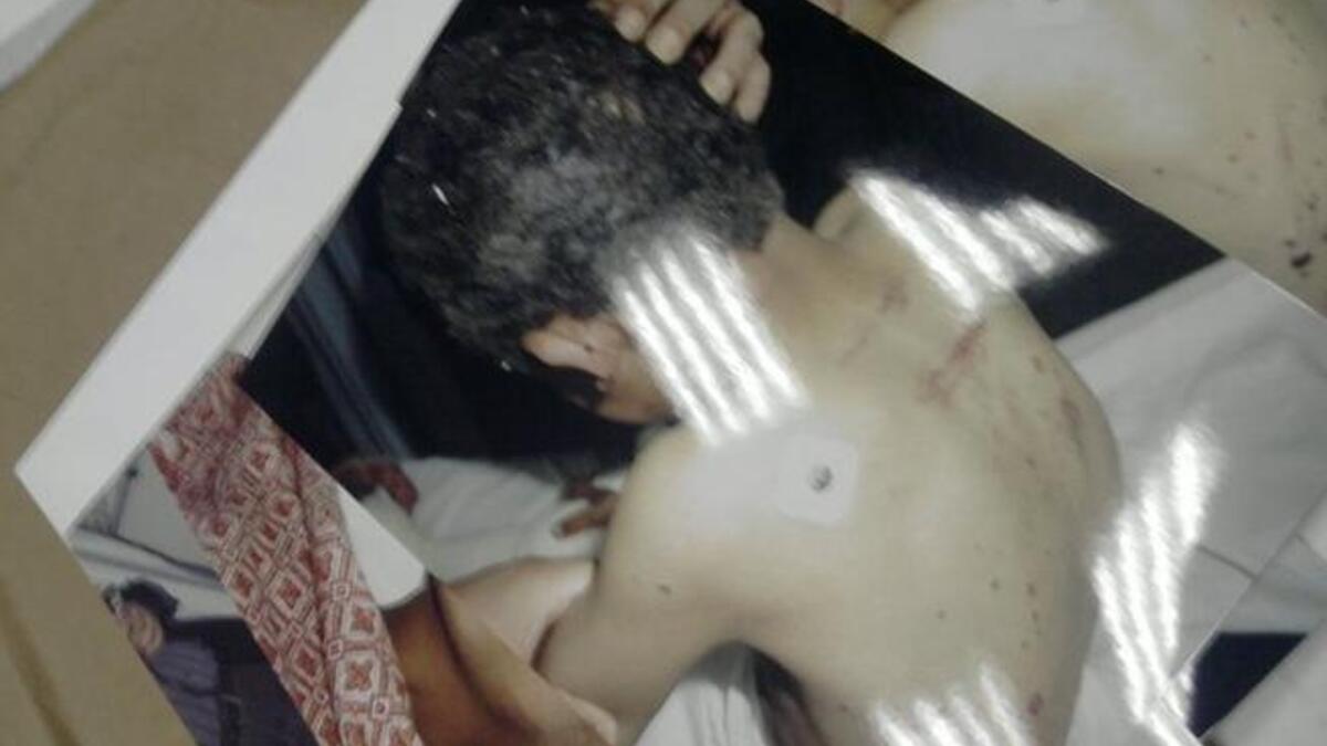 Shocking: images of torture victims, this one of a tortured minor found on the state security premises amongst files.