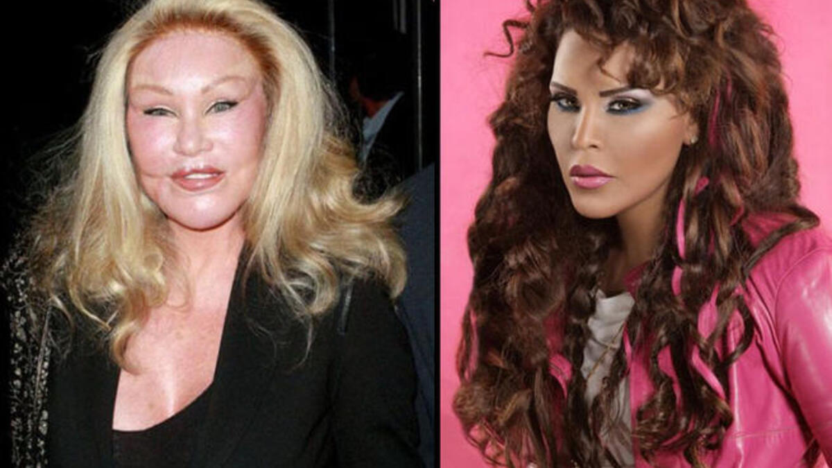 With plastic surgery so strongly in the mix, there’s no telling who she really looks like, but one could certainly compare UAE songstress Ahlam to an Arab version of Jocelyn Wilderstein. Train wreck alert!