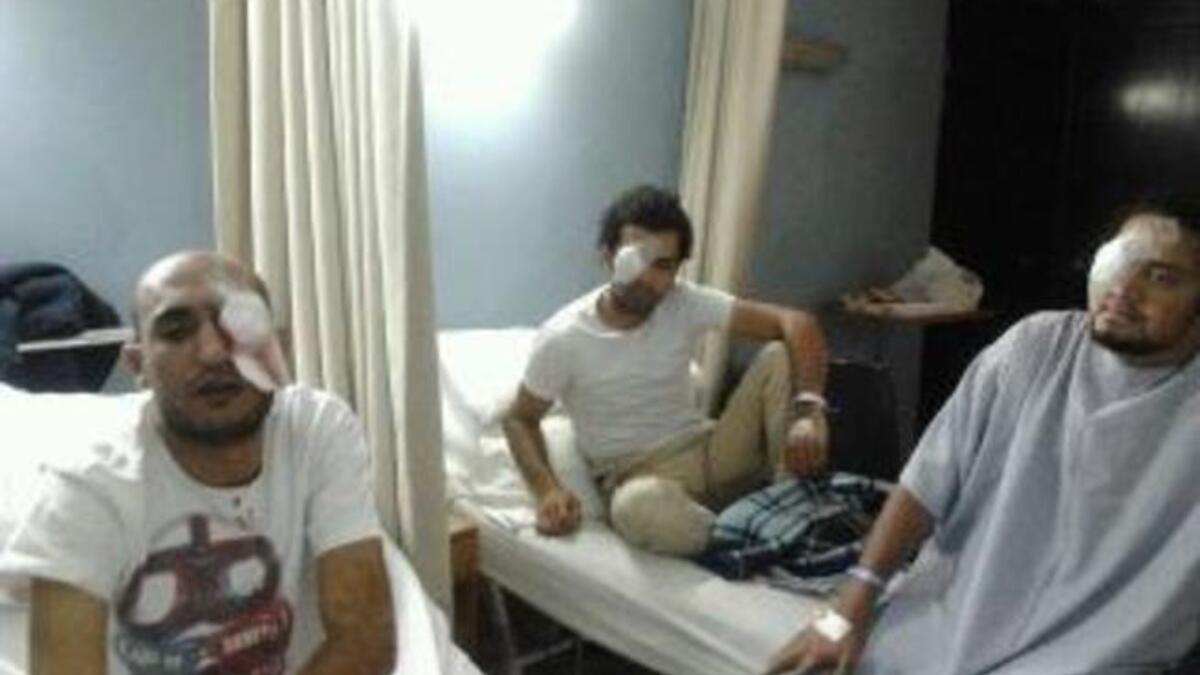 As people flooded the iconic square that inspired other Arab squares since to aspire to feats as freedom, the media lens
shifted back to this deja-vu scene of people power. But those in power now, SCAF were plainly abusing their authority,
issuing orders to target heads. Personnel could be heard receiving orders to aim for protesters' 
eyes.