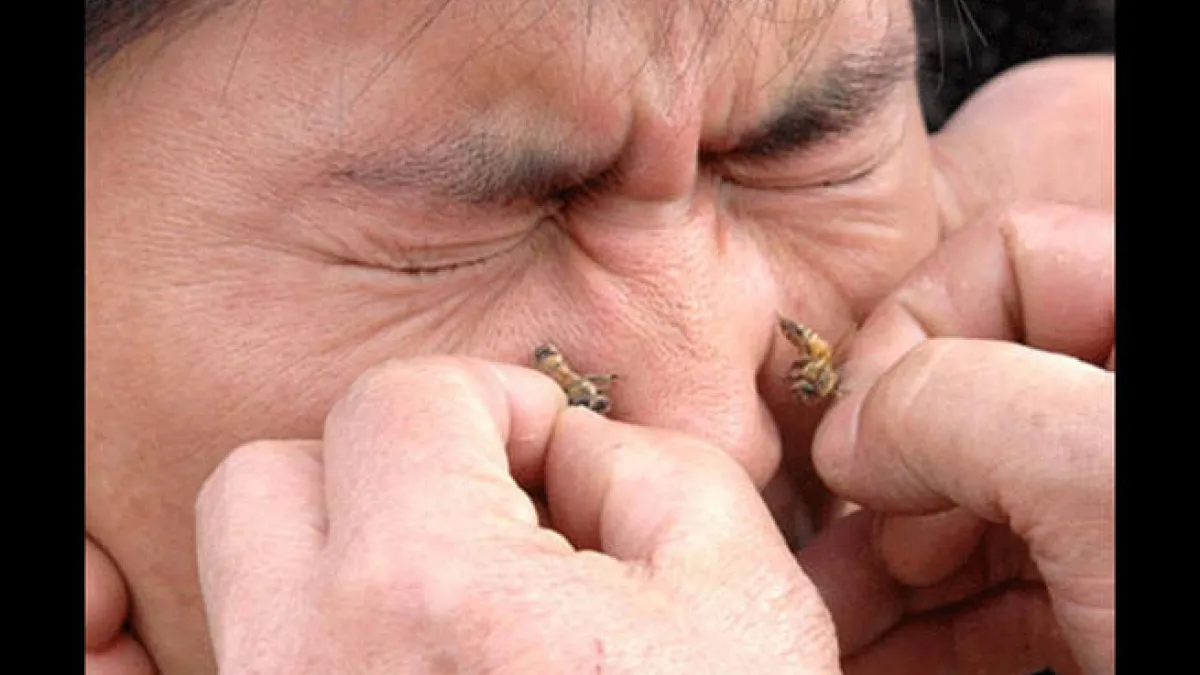 Bee sting facial
