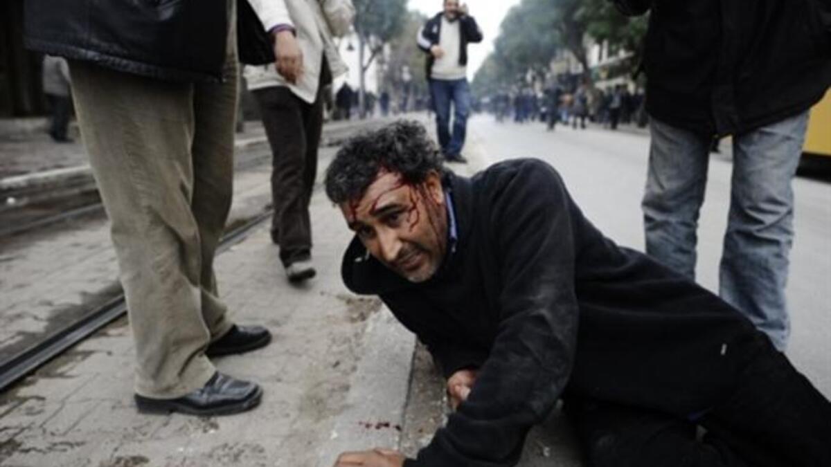 A man lies injuried during a demonstration.