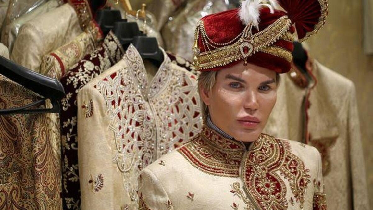 أصبح الشاب البرازيلي المقيم في لندن رودريجو ألفيس، نسخة مطابقة للعبة الأطفال "كين" يعرفها الكثيرون بأنها النسخة الرجالية من دمية باربي الشهيرة، فقد كان هوسه منذ كان صغيرًا.