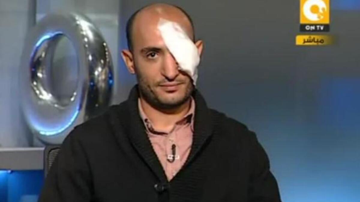 For Egypt's brave people who forced Mubarak's hand the first time round in their endurance & staying (in the square) power, 
the price of their elusive & transitory freedom has come at a high human cost. The Supreme Council of the Armed Forces (SCAF), 
are taking snipes at Egyptian eyes in a vicious blow to the civilian victors of the revolution.