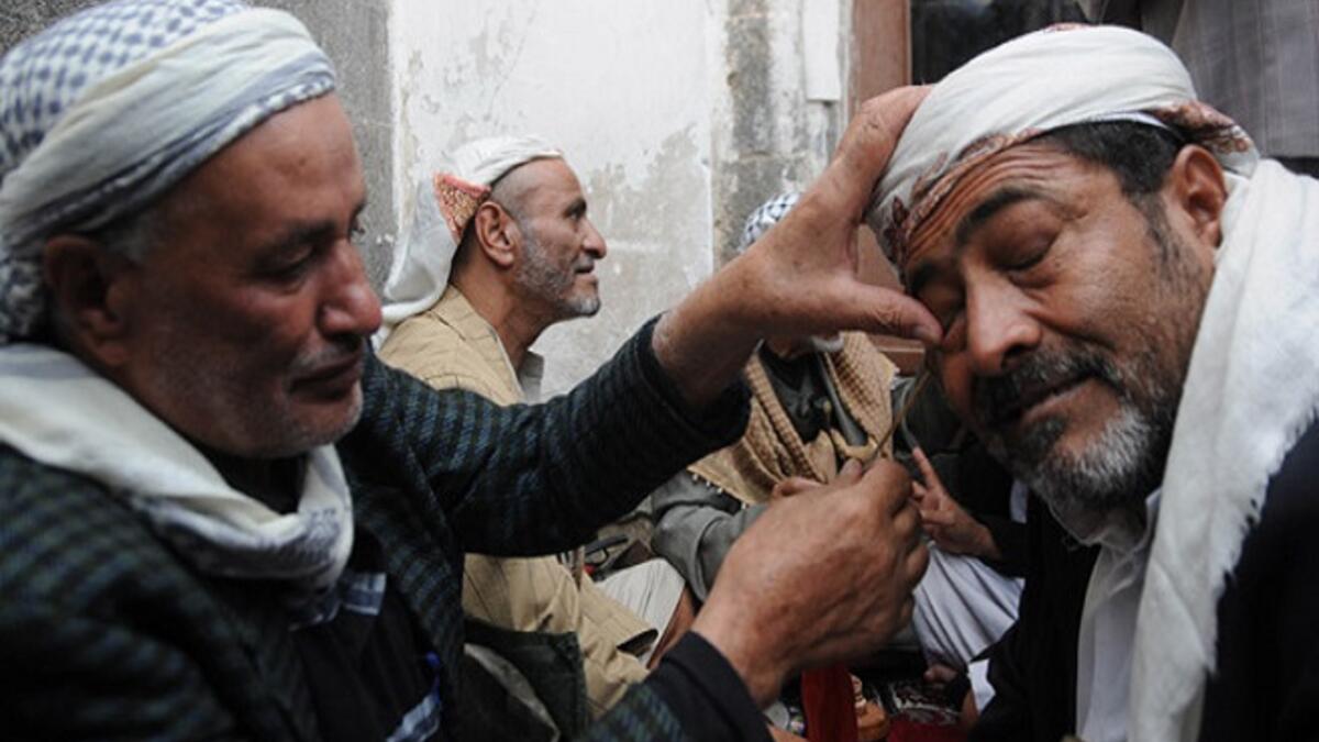 تكحيل العيون في اليمن: في الجامع الكبير يجلس مجموعة من كبار السن يحملون مكحلة وأمامهم يتزاحم عشرات الأشخاص ينتظرون دورهم في تكحيل أعينهم وتعد هذه العادة من أبرز سمات استقبال رمضان اضافةً إلى التعطر بماء الورد.