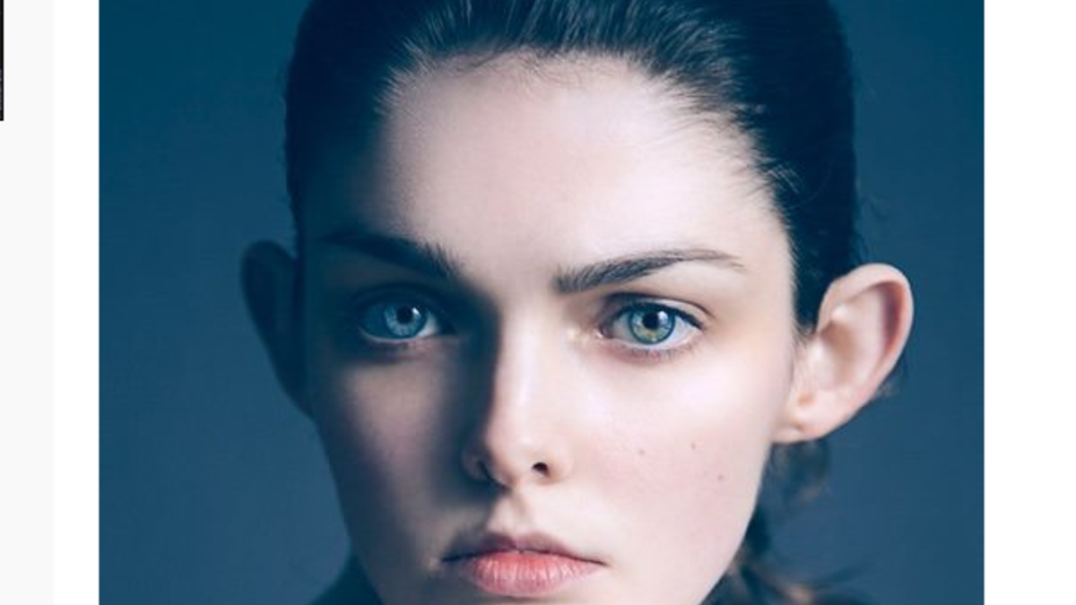 في مرحلة الطفولة، تعرضت "لورا أوغرادي" لمضايقات الجميع بسبب أذنيها الكبيرتان البارزتين، مع ذلك لم تفكر بتغير شكليهما جراحيًا، وعلاوة على ذلك، لمع نجمها بسبب أذنيها.