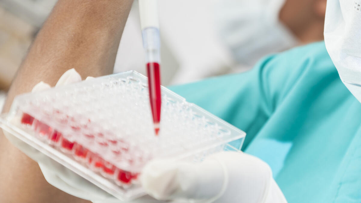 يتم انتقال المرض "الايدز"عن طريق الاتصال الجنسي على مستوى العالم هو بين طرفين من جنسين مختلفين ويتم ايضا من خلال التعرض لدم ملوث بالمرض او انتقال الفيروس من الأم الحامل لطفلها.