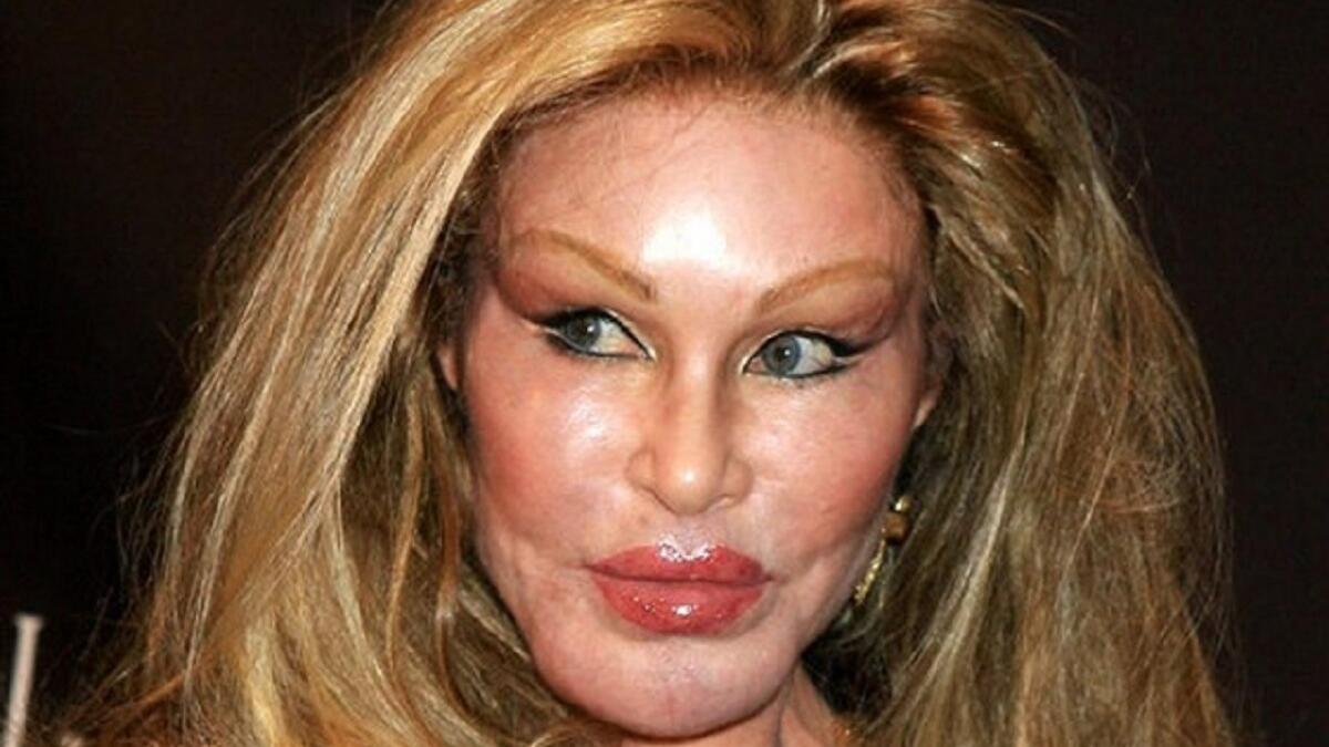 سلين وايلدنشتاين: يطلق عليها اسم "المرأة القطة"، تعرف بشخصيتها اللامبالية لانتقادات الآخرين وتتبنى نمط حياة باذخة، إذ تبلغ فاتورة أكلها حوالي 550 ألف دولار سنوياً ! .. جنت جوسلين من تسوية طلاقها 2.5 مليار دولار، مع مبلغ إضافي قدره 100 مليون دولار