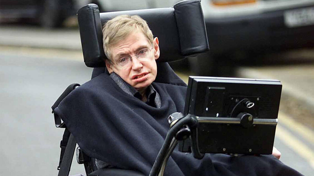 العالم ستيفن هوكينغ: أصيب بمرض التصلب الجانبي الضموري، وهو اضطراب يتسبب في موت الخلايا العصبية التي تتحكم في العضلات الطوعية وتؤدي إلى انخفاض حجم العضلات.