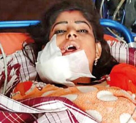 Video: Dancer Shot in The Face for Taking a Break at Indian Wedding