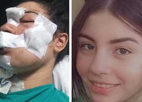 بعد أن طعنها وشوه وجهها.. إسراء عماد تعفو عن زوجها وتعود له!