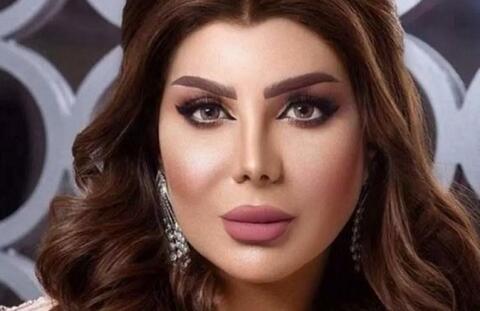 إلهام الفضالة تثير الجدل بوجهها المتورم و تكشف عن السبب