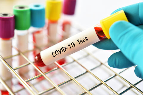 New Mysterious COVID-19 Variant Detected in France