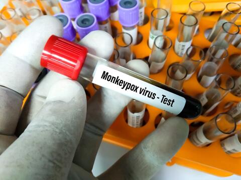 WHO: Monkeypox Will Not Evolve Into a Pandemic 
