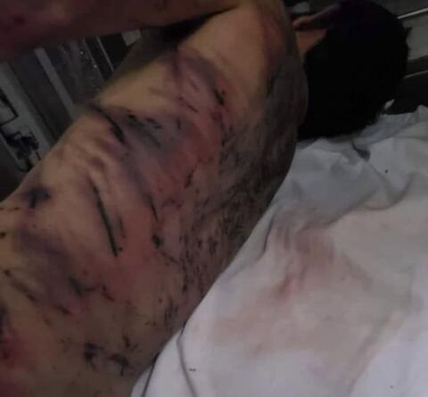 Viral: Syrian Refugee Tortured to Death by Lebanese Security 