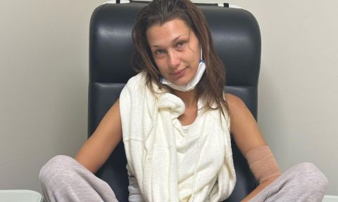 أجمل إطلالات بيلا حديد الصيفية.. وتفاصيل مرض لام الذي عانت منه