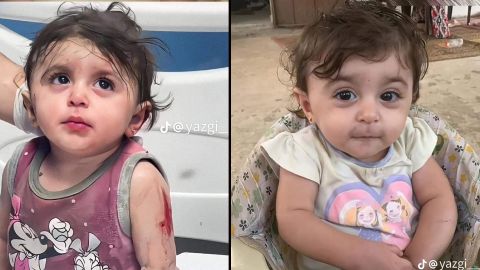 Palestinian baby Sham feels better after injury: (Photo)