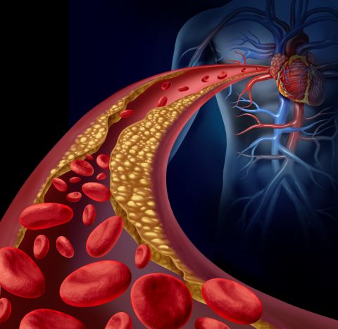 Foods That Clean Your Arteries and Lower Cholesterol