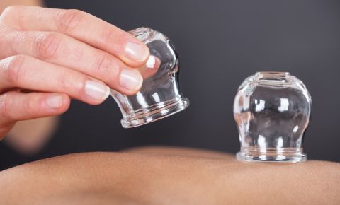 مواعيد الحجامة في رمضان 2025، وهل تفطر ؟