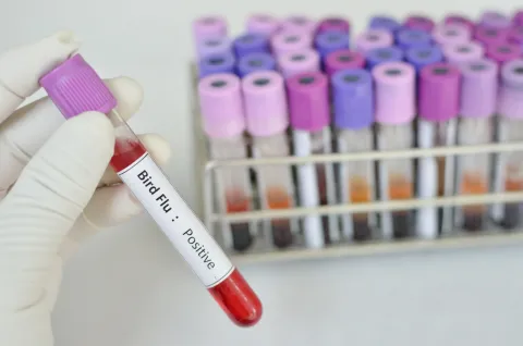 Second U.S. bird flu case, linked to Michigan dairy farm