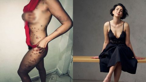 Iranian actress shows body full of bullet scars for taking part in Mahsa Amini protest 
