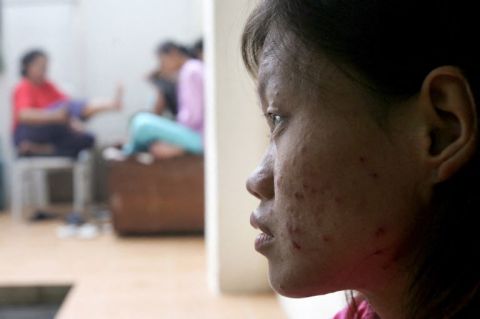 WHO declares Mpox outbreaks in Africa a global health emergency