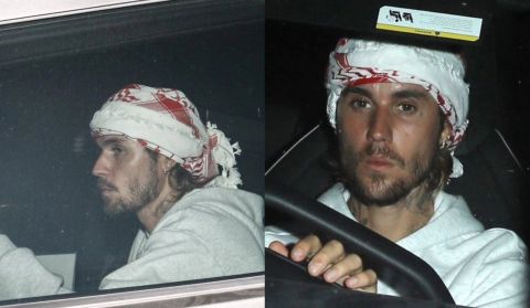 Justin Bieber wears Keffiyeh to show of solidarity with Palestine amid Gaza conflict