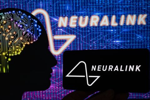 Neuralink to implant its brain chips in Canada