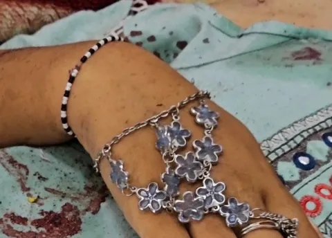 ملابس العيد بلون الدماء.. هكذا أفاقت غزة على عيدها (فيديو+صور)
